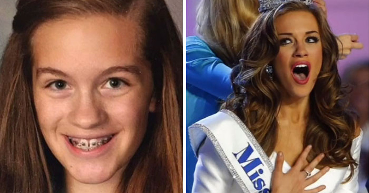 30 People Who Were Hit Hard By Puberty Share Their Glow-Up Photos In Viral TikTok Challenge