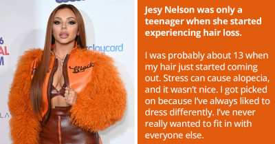 Aside From Jada Pinkett Smith, These Are The Celebrities Who Have Opened Up About Dealing With Alopecia