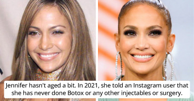10+ Celebrities Who Have Denied Or Sternly Spoken Against Plastic Surgery Or Cosmetic Modifications