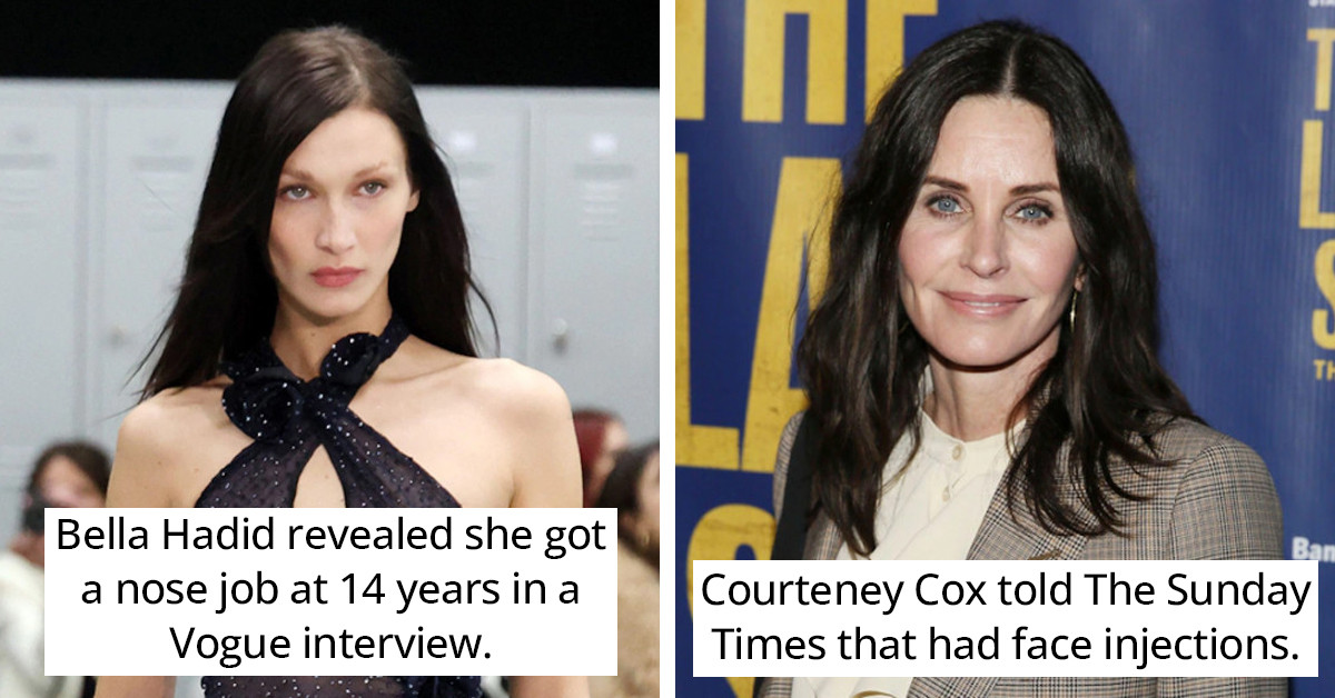 36 Times Celebrities Acknowledged That They Have Undergone Cosmetic Surgery