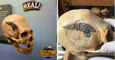 2000-Year-Old Skull Of A Peruvian Warrior Proves That Advanced Surgery Was Done In Ancient Times
