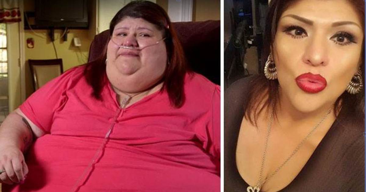 Amazing Before and After Weight Loss Photos from Women Who Were Morbidly Obese