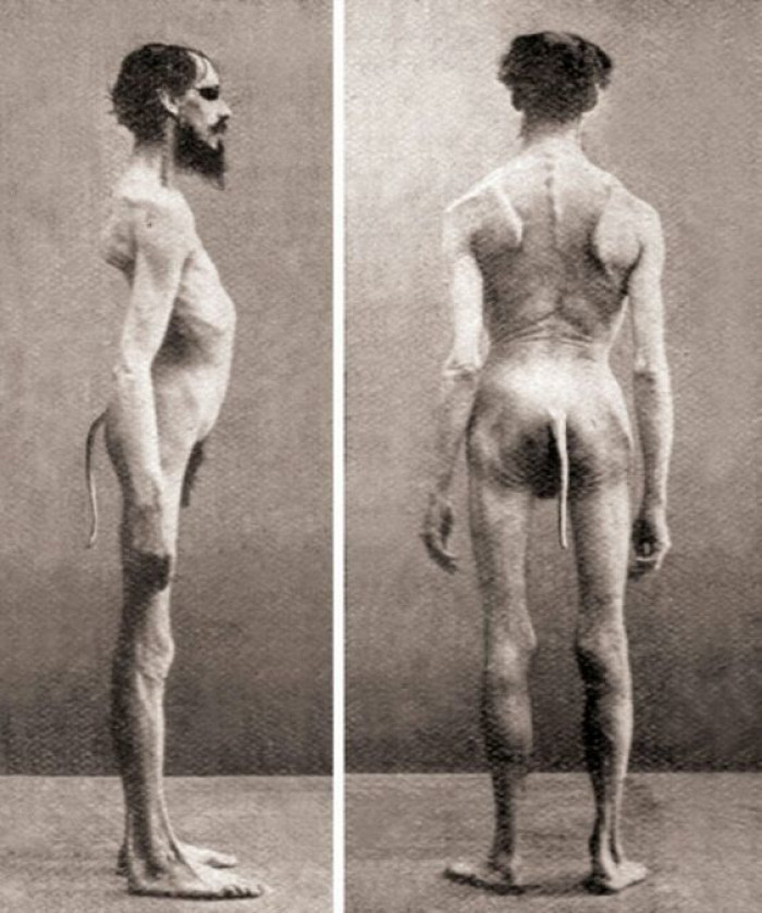 13. The man with a tail.