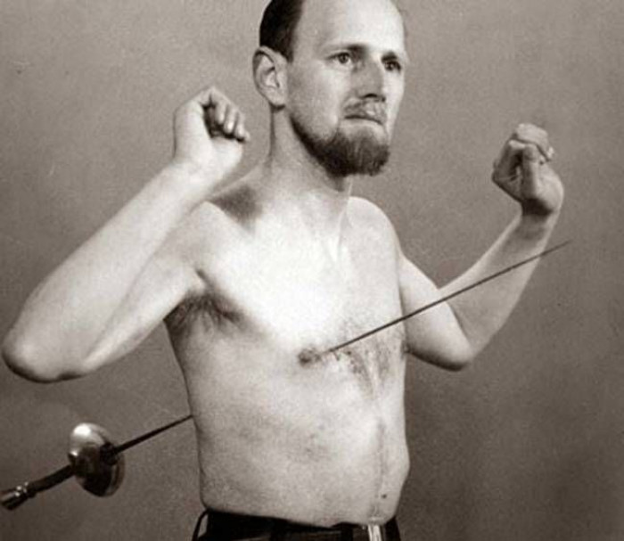 1. The Human Pincushion