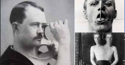 Terrifying Vintage Circus Photos That Will Give You Nightmares