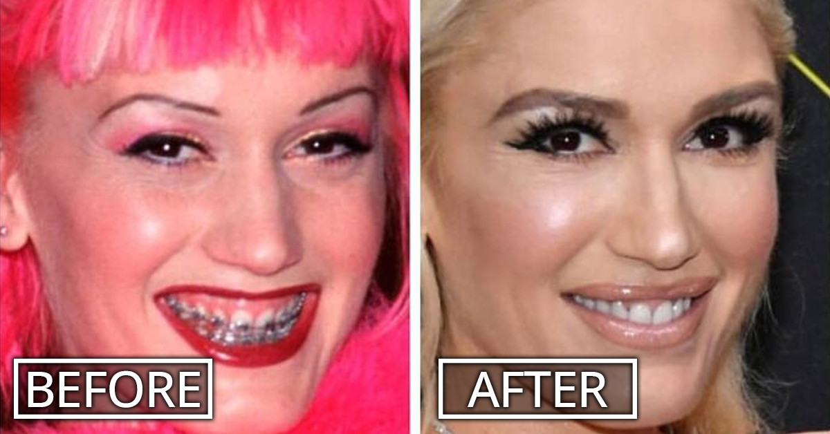 30 Pictures Shared By An Instagram Account Showing The "Before And After" Pictures Of Celebrities