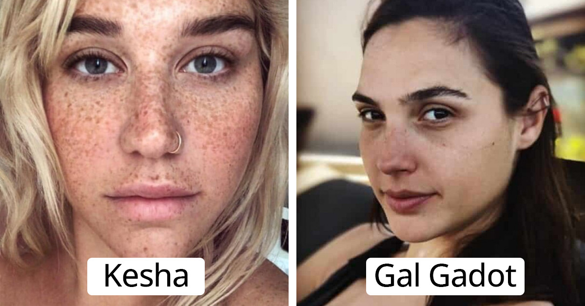 22 Pictures Of Celebrities Who Are On A Makeup Free Spree And They Truly Look Stunning