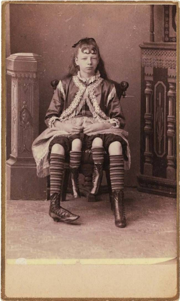 4. Four-Legged Woman