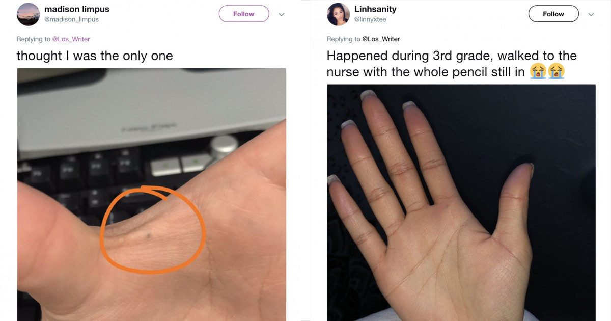 People Who've Been Hurt With a Pencil Share The Lead Mark And Story Years Later