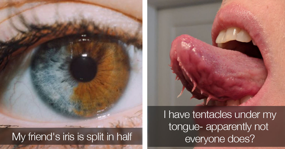 Genetically Unique Super Humans That Defy The Laws of Evolution