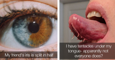 Genetically Unique Super Humans That Defy The Laws of Evolution