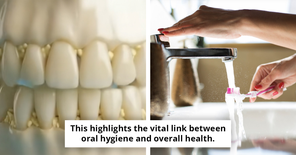 Chilling demonstration reveals the potential impact on your teeth after 30 days without brushing - a must-see for dental hygiene awareness!