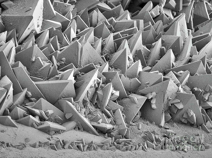 7. Kidney Stone Surface As Seen In An Electron Microscope