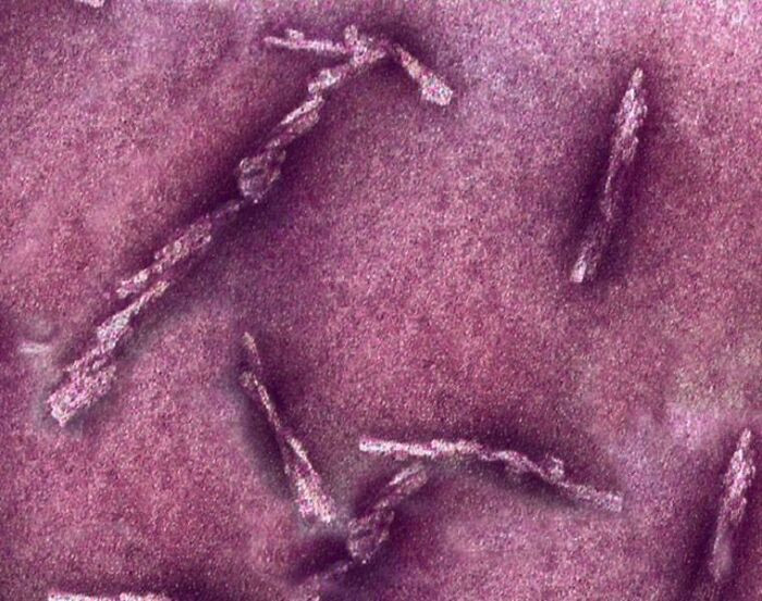 "A False-Color, High-Res Microscopic View Of Prions"