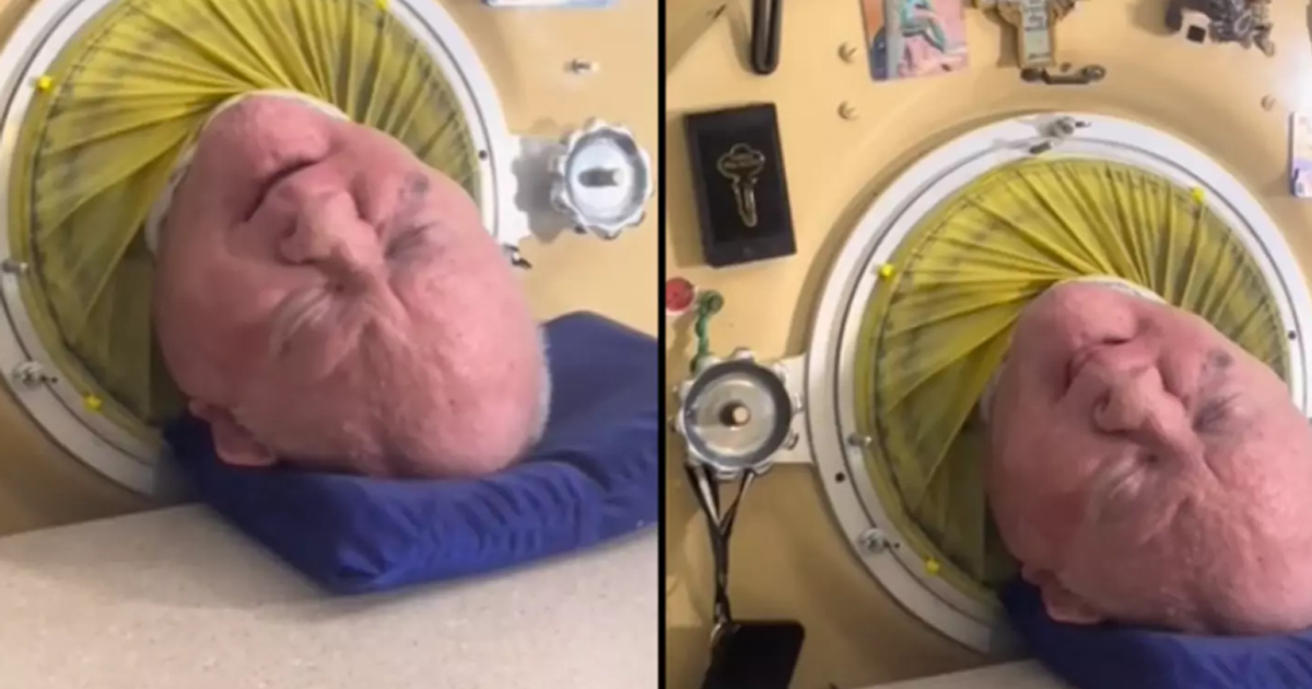 Man Who Has Lived Inside Iron Lung For More Than 70 Years Relives Harrowing Moment Machine Stopped Working