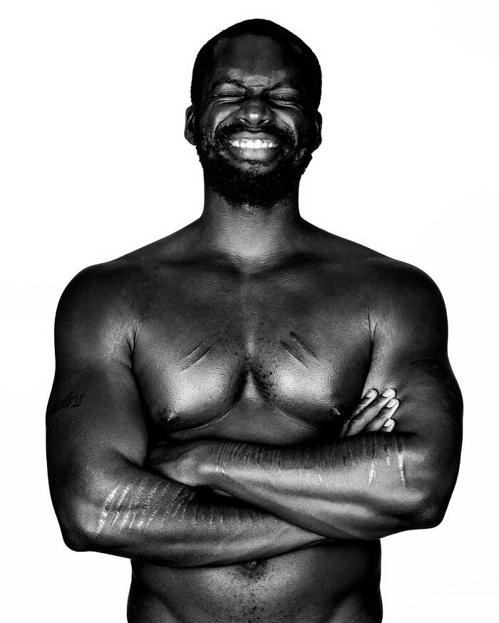 “Derek Owusu” - Scars