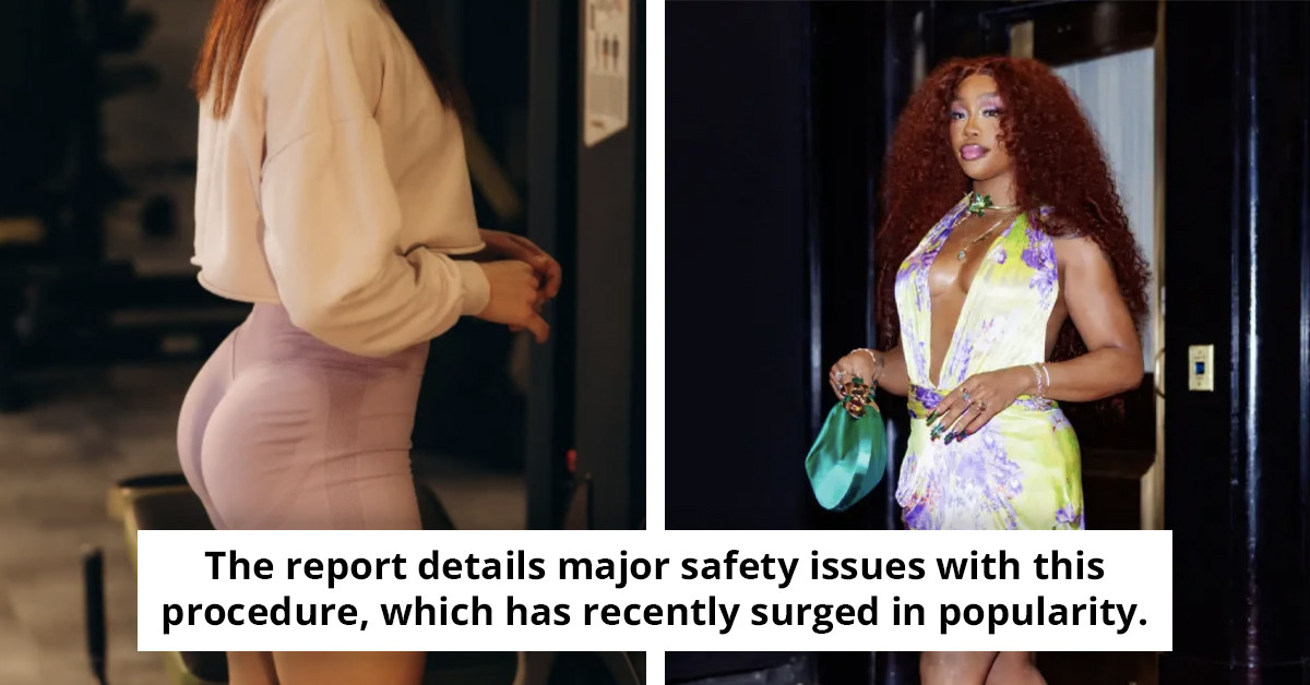 New report reveals alarming trend of 'risky' BBL procedures occurring in Airbnbs and public restrooms, prompting urgent caution.