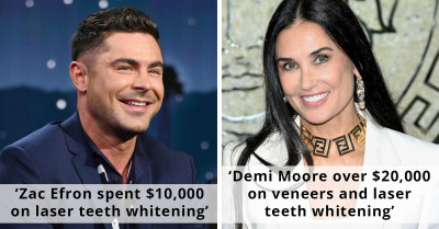 7 Celebrities Who Had Some Pricey Dental Makeovers
