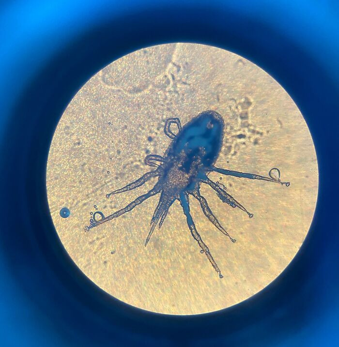 "Sitting In Bed, Felt A Bite, Saw This Little Guy Crawling On Me. Threw Him Under The Microscope"