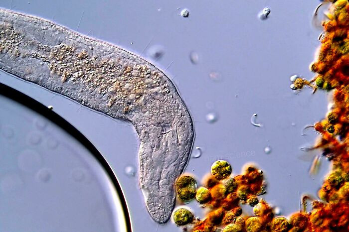 "Freshwater Flatworms Under DIC Microscope"