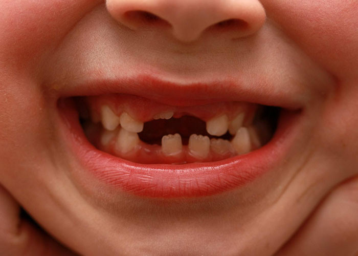 22. Well, she has to do something with all those teeth.