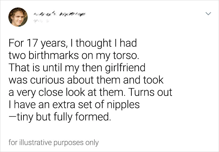 Girlfriend discovers that her boyfriend has two sets of nipples.