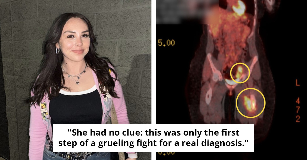 Young Woman, 23, Raises Alarm Following Misdiagnosis of Advanced Cancer as 'Height'
