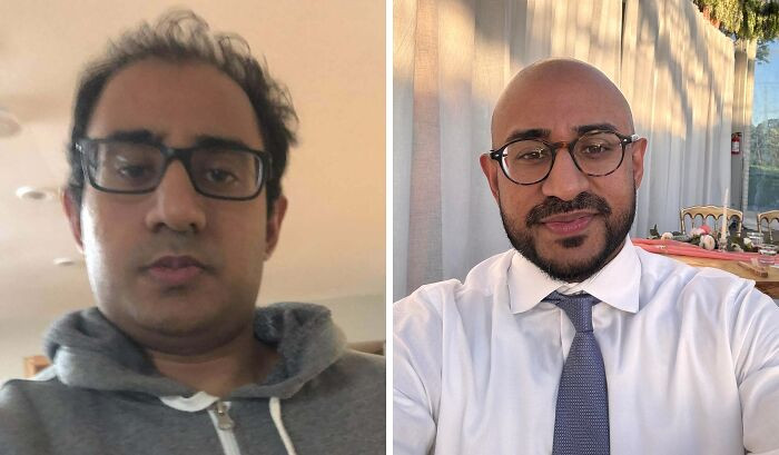 "From Stressed And Balding To Getting Healthy"