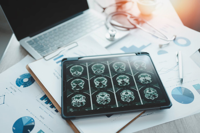Physician discussing early warning signs of dementia in young adults