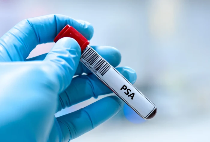 Surgeon speaking about prostate cancer screening awareness for older men’s health