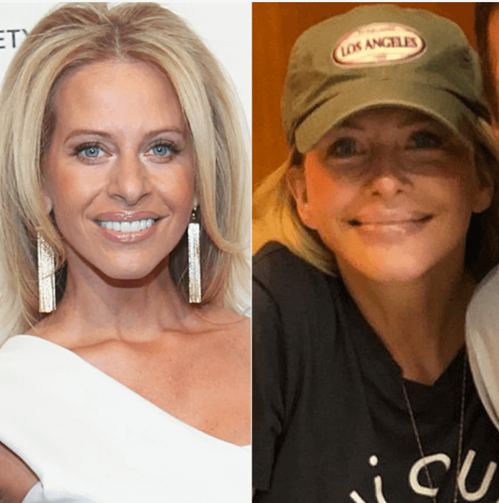 17. Dina Manzo admitted to having her nose repaired.