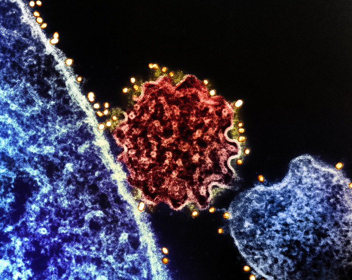 Health official addresses outbreak, warning of Nipah virus without cure
