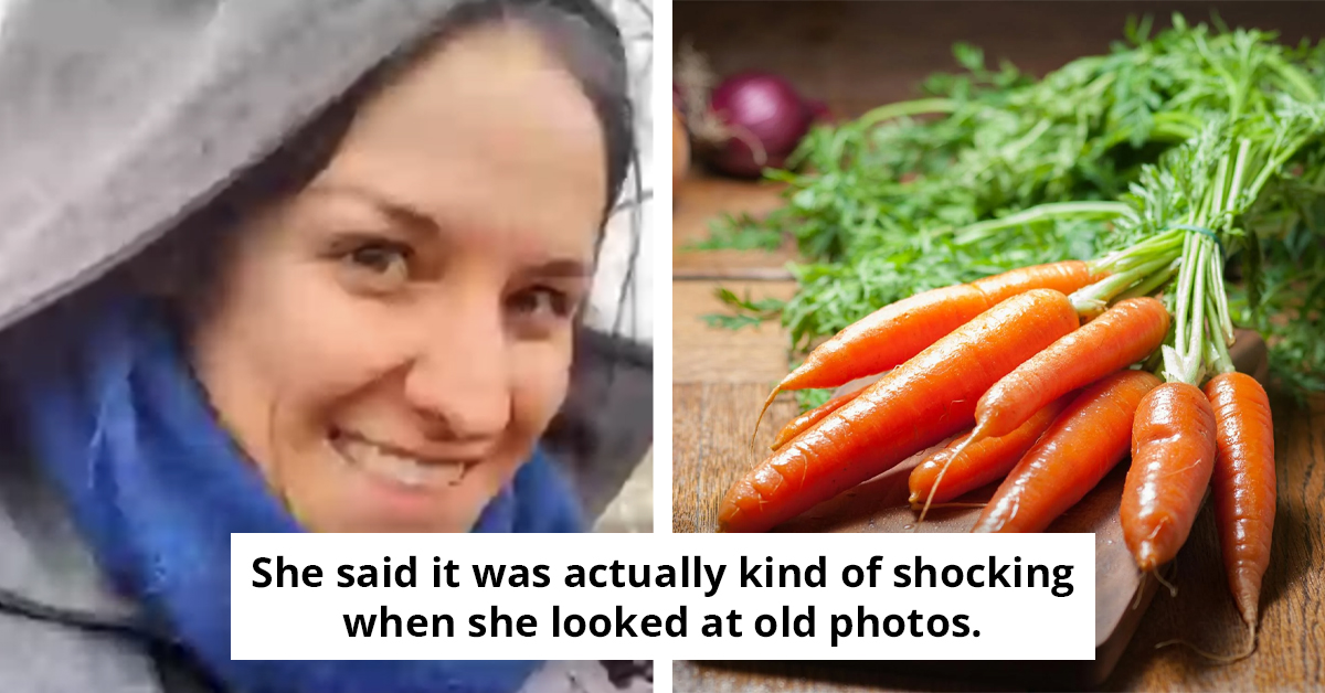 Woman’s Before and After Photos Expose the Unexpected Impact of Eating Carrots Daily