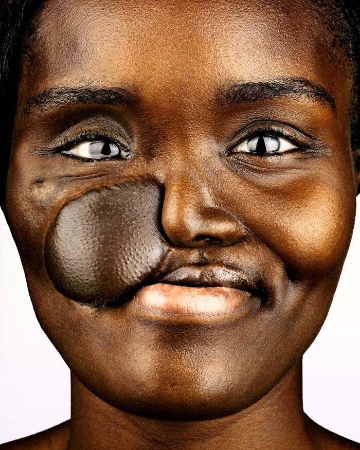 “Crystal Mitchell” - Scars