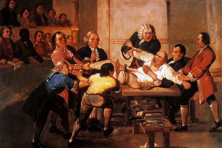 Surgeries before the advent of anesthesia were a terrifying experience for patients