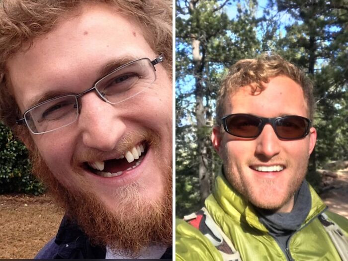 "Just Kind Of An Interesting Change. Before vs. After"