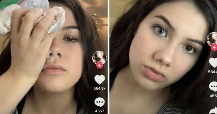 "This Influencer Is Telling Children On TikTok It's Okay To Put Bleach In Their Eyes, Claiming It Changes Eye Color"