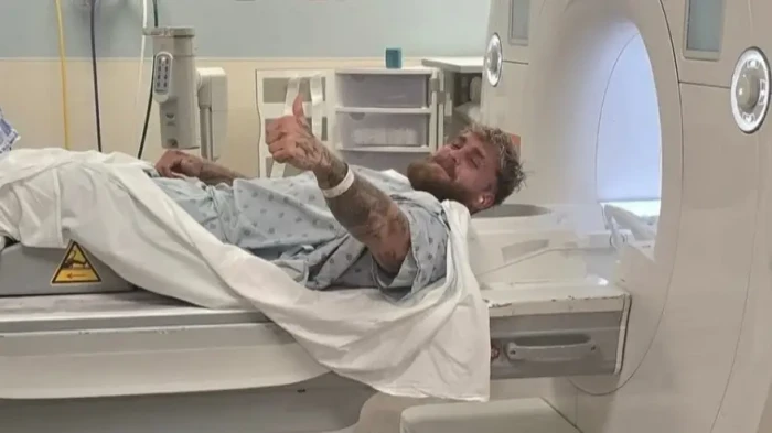 Jake Paul recovering from severe jaw injury after Anthony Joshua fight