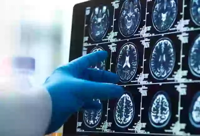 It All Comes Down to Cognitive Function.