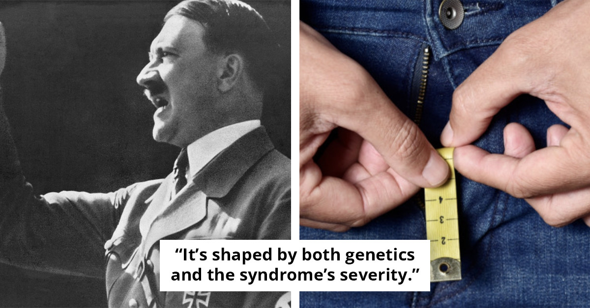 DNA evidence uncovers Hitler's 'micropenis' as man reveals rare genetic disorder impact