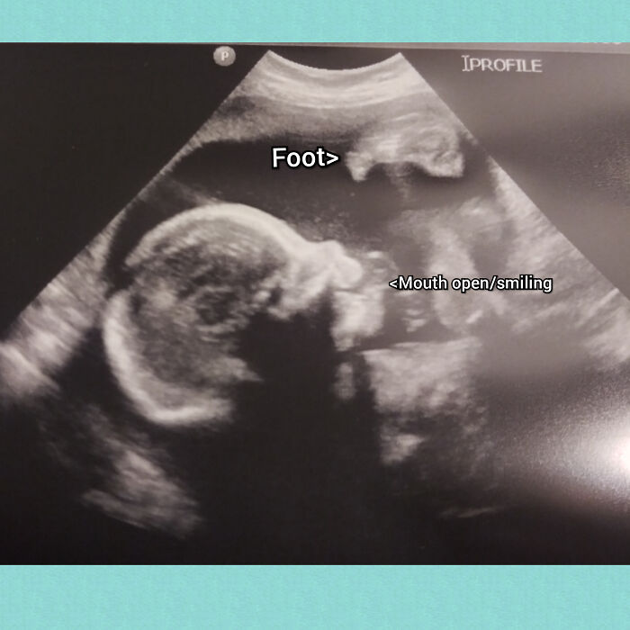32. My Mom Ignored Me When I Showed Her Pictures Of The Baby Boy I'm Currently Pregnant With... Here Mom, Here's Pictures Of Baby Marley!