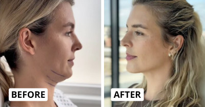 From Subtle Tweaks To Total Glow-Ups: 30 Real People Who Changed Their Looks (And Lives)