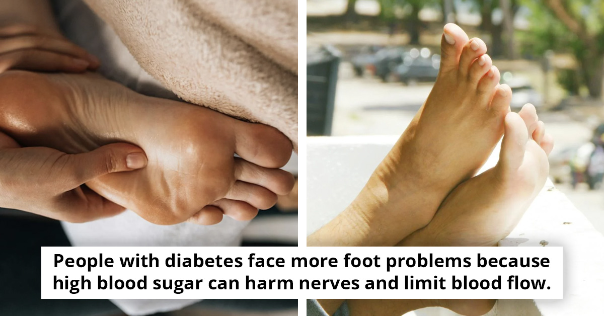 Pharmacist Reveals Hidden Warning Signs in Your Feet That Could Point to Serious Health Conditions