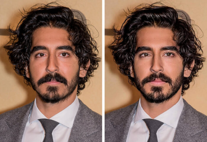 8. Dev Patel