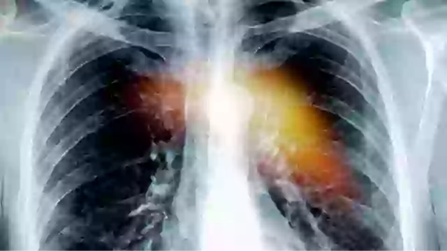 Congenital heart diseases like ASD affect almost 1 in 100 babies born in the UK