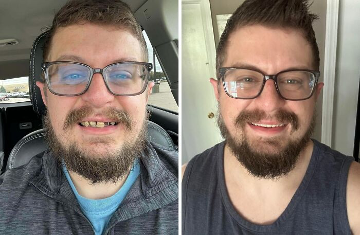 "Not Sure If This Counts (32-33)"