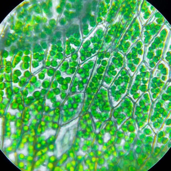 "Took Some Pictures Of Chloroplasts Under The Microscope"