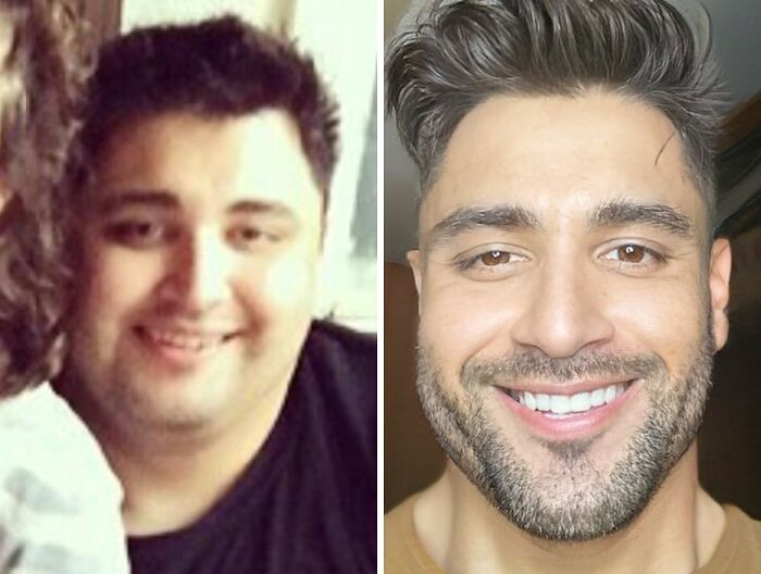 "I Lost 120 Lbs. From A Fake Smile Because I Was Depressed And Hated Myself To A Genuinely Real Smile Because I’m Much Happier With Who I Am"