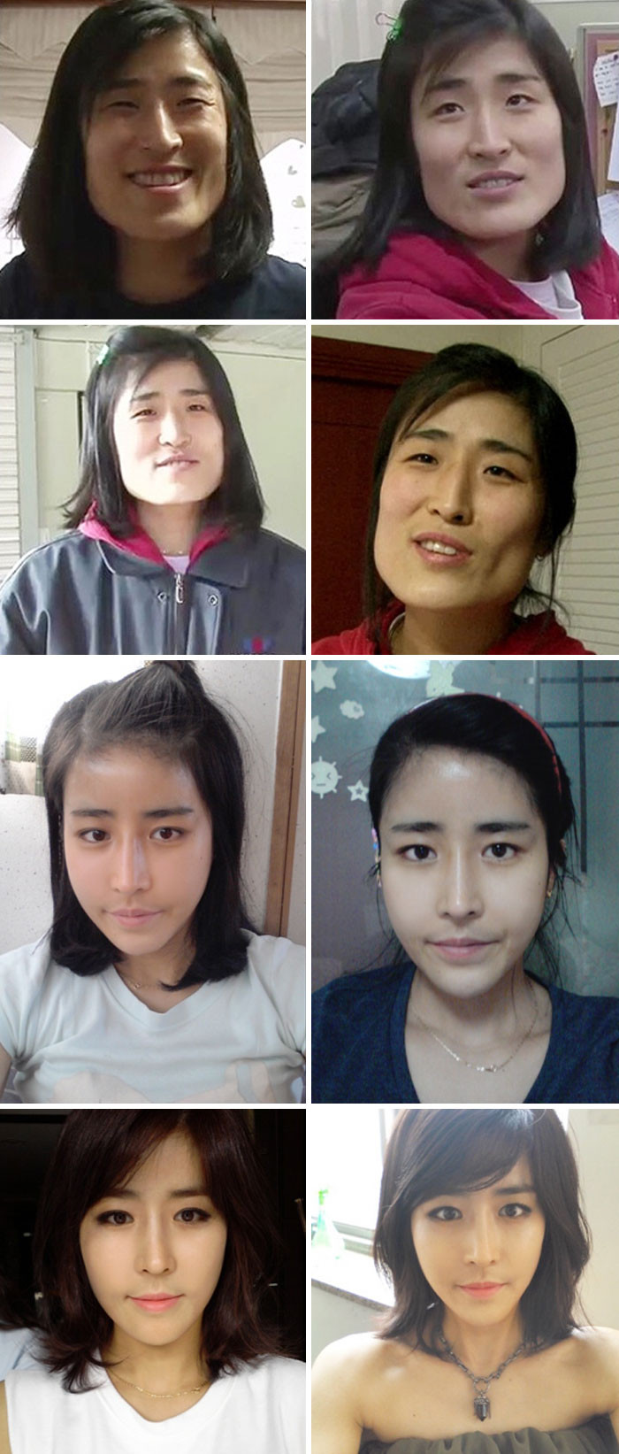 "The Wonders Of Plastic Surgery"