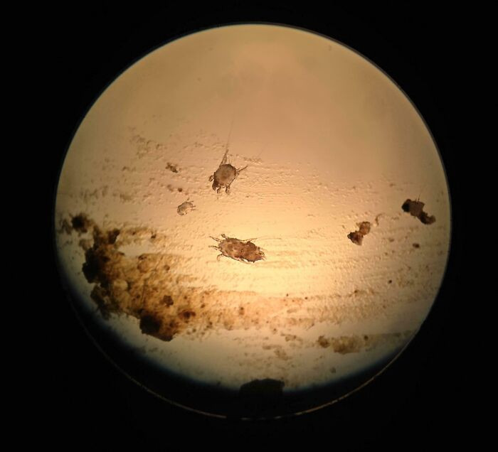 "Took A Picture Of Cat Ear Mites Under A Microscope"